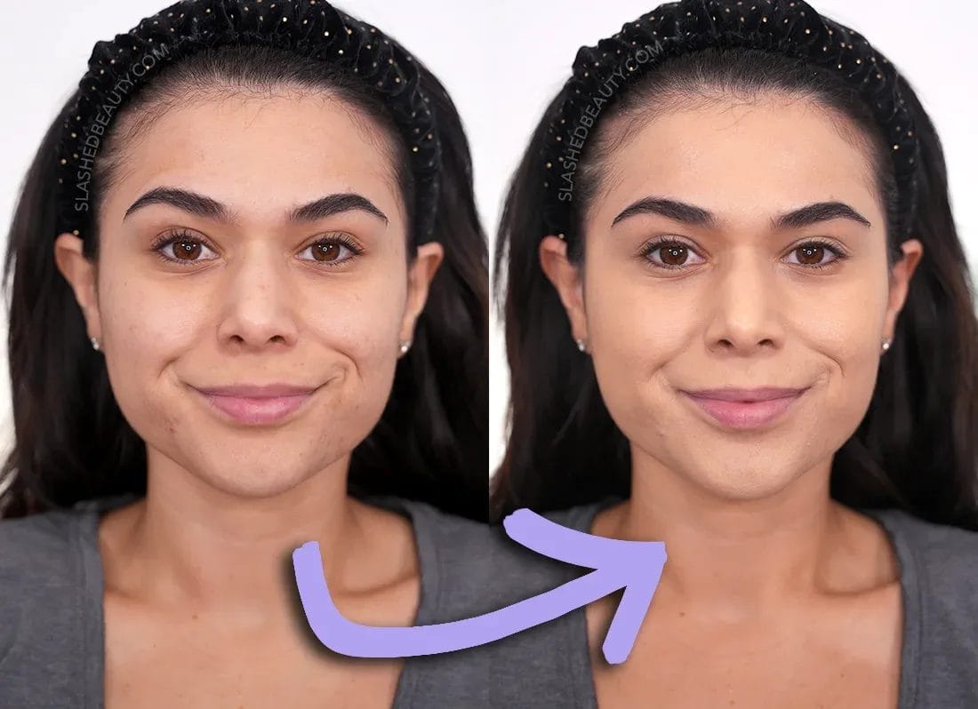 about-face-performer-foundation-lm1warm-before-after | Slashed Beauty Side-by-side photos showing before and after applying the about-face Performer Skin Focused Foundation. Medium coverage is achieved, evening out redness and dark spots. | about-face Foundation Review | Slashed Beauty